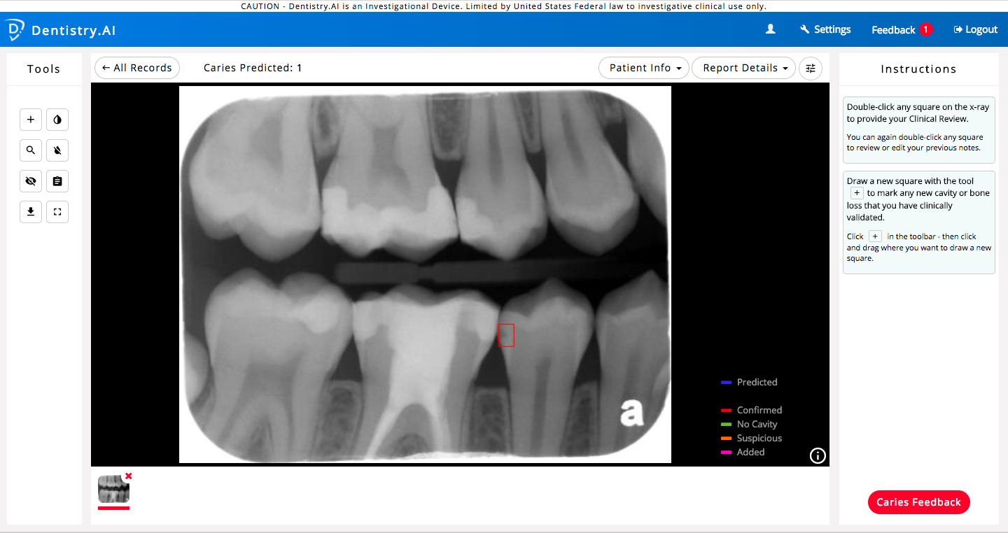 dentistry ai dental intelligence artificial caries clinical dentists areas deployment detecting starts software highlighting rays examining closely probability instantly helps